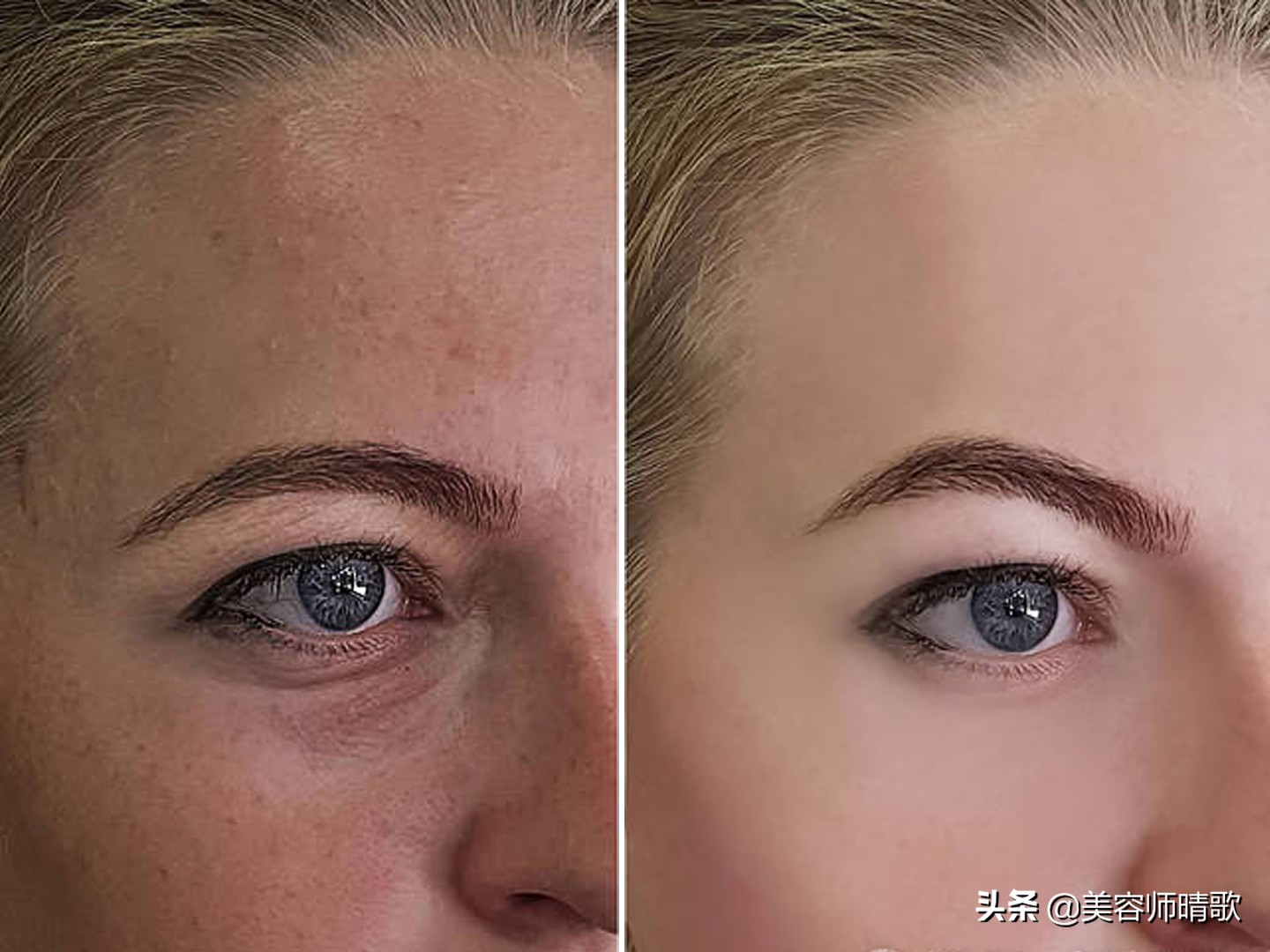 淡斑小白瓶精华二代,小白瓶美白淡斑护肤品推荐