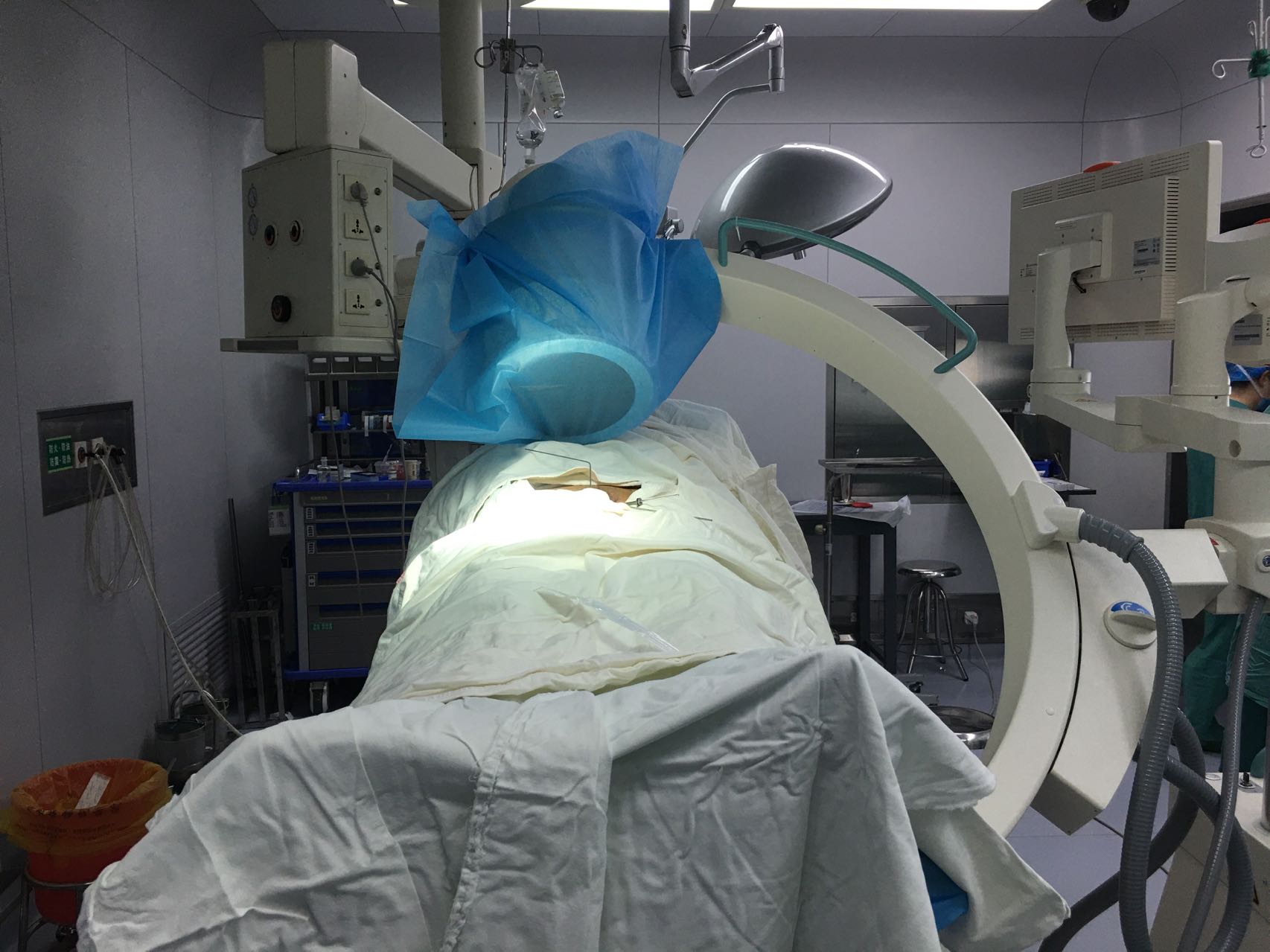 一名骨科医生股骨骨折经历,骨科朱医生