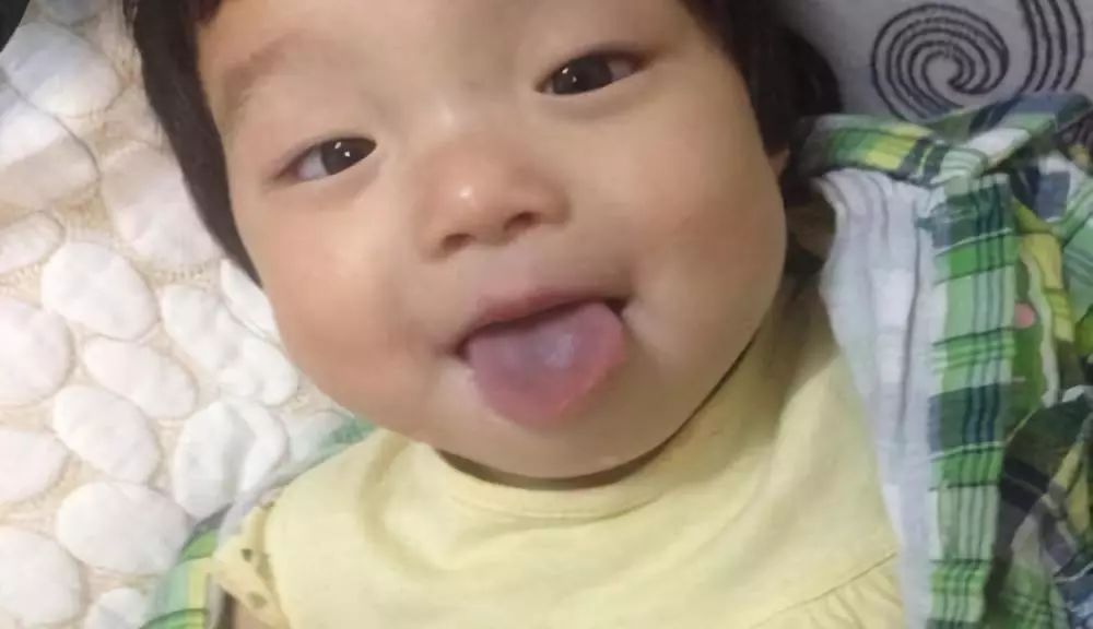 宝宝鼻梁发青是什么原因,婴儿鼻梁发青是什么征兆