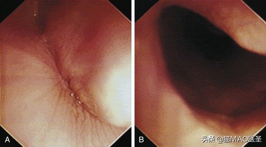 犬猫内窥镜检查气管食道,猫狗内窥镜