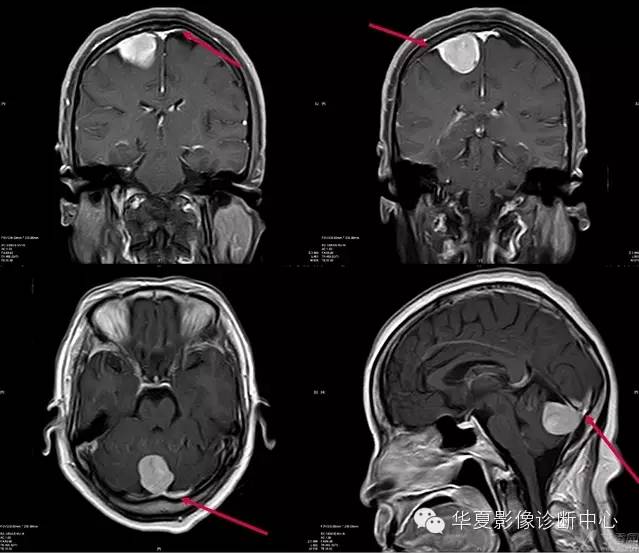 神经系统解剖及定位诊断视频,神经系统影像解析