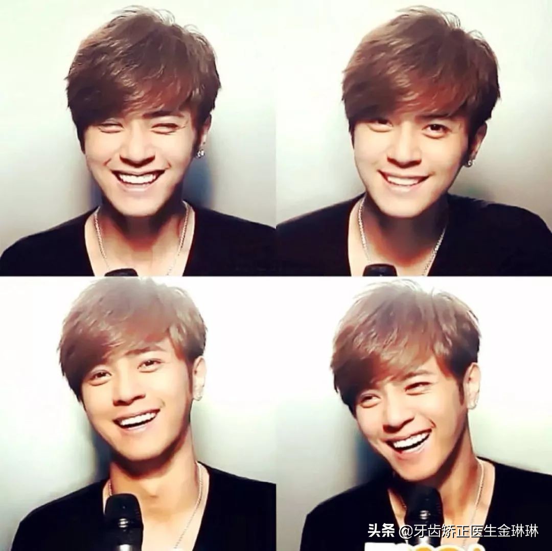 全明星都在做的烤瓷牙真的好吗,为什么明星全瓷牙要几百万