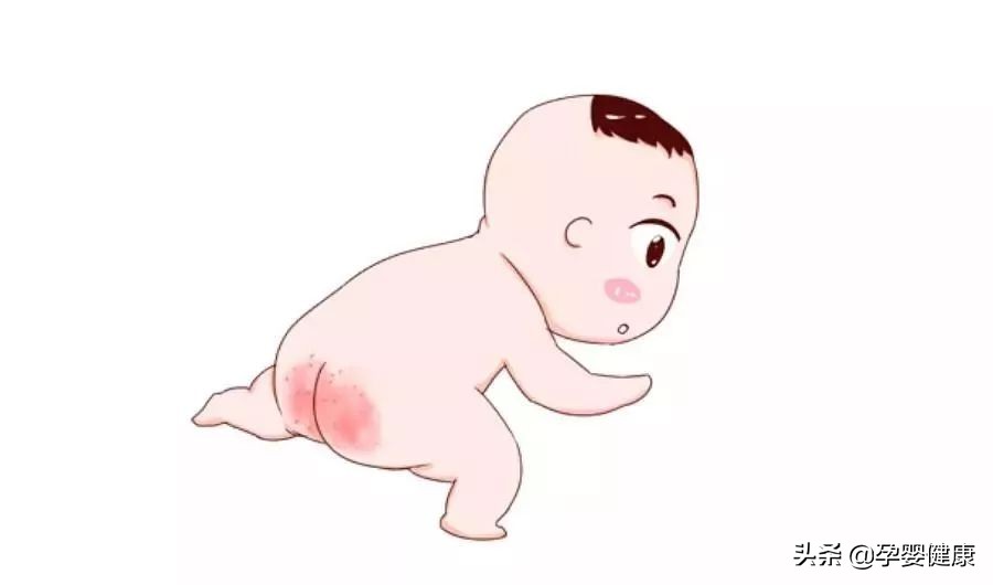 让宝宝告别红屁屁,小屁屁防护