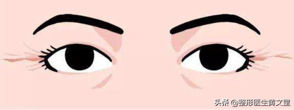 眼部去皱抗衰,眼部细纹如何抗衰