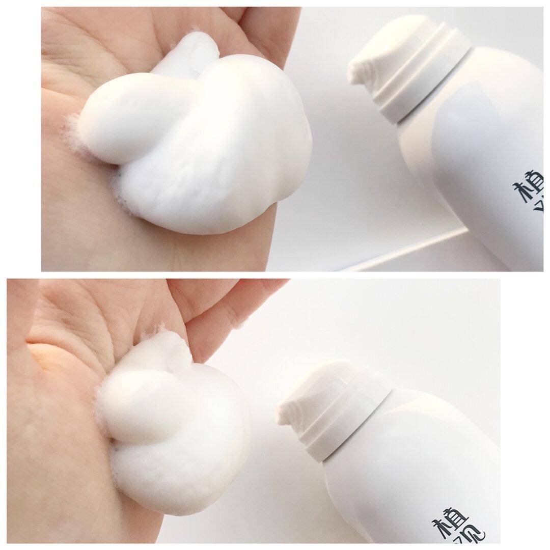 做好清洁有利于祛痘吗,清洁护肤品怎么做的好用