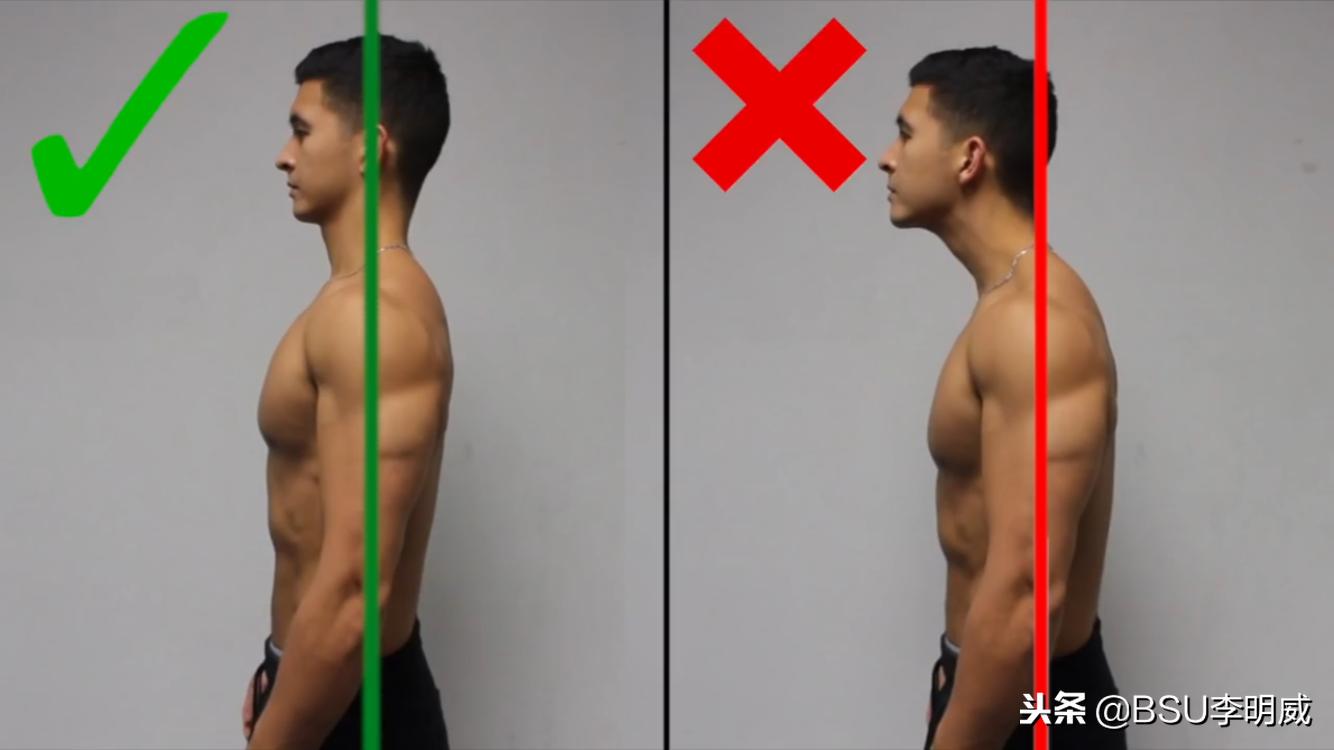 躺床头前倾矫正,怎么纠正头前倾