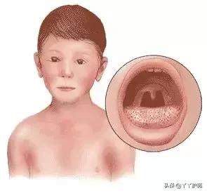儿科常见出疹性疾病,儿科常见出疹性疾病有哪些