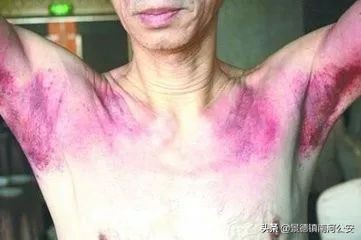 “拍死”6岁男孩！红极一时的“神医”被判刑！