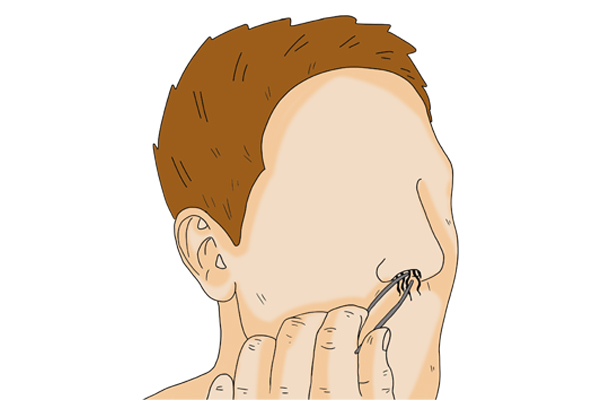 鼻毛窜出来后应该是剪掉还是拔掉,鼻毛长出来了要不要剪掉