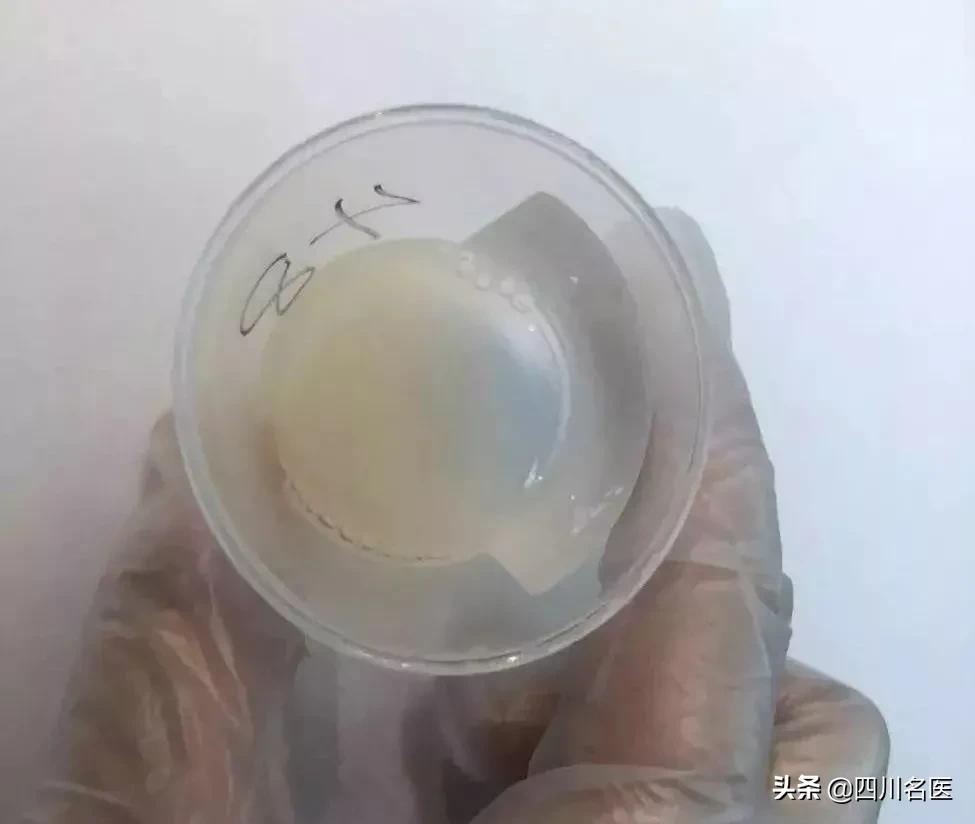 精子是如何产生的百科,精子是不是每天都能生成