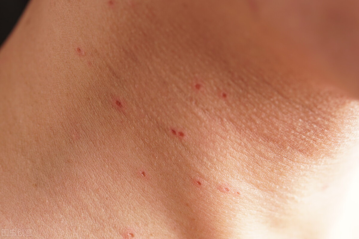 8种常见皮肤问题如何预防与治疗,9种日常小妙招帮你解决皮肤问题