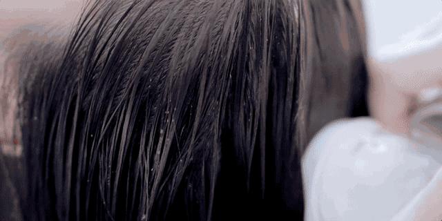 头皮屑特别多要当心什么病,头皮屑太多的原因和解决方法