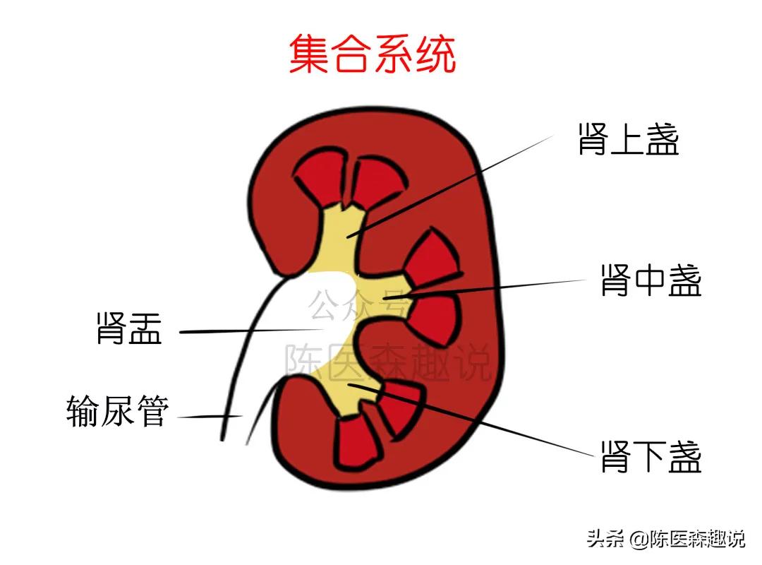 肾下盏结石怎么能排出来,左肾结石6mm多久能自然排出