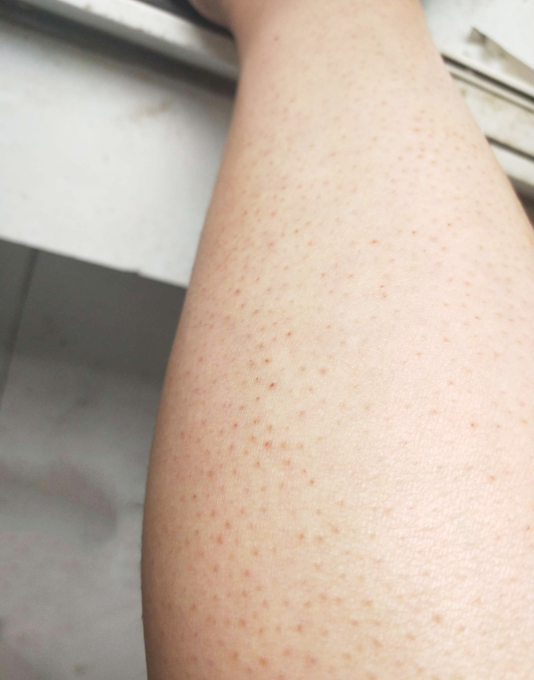 猕猴桃脱毛小妙招,如何给猕猴桃脱毛