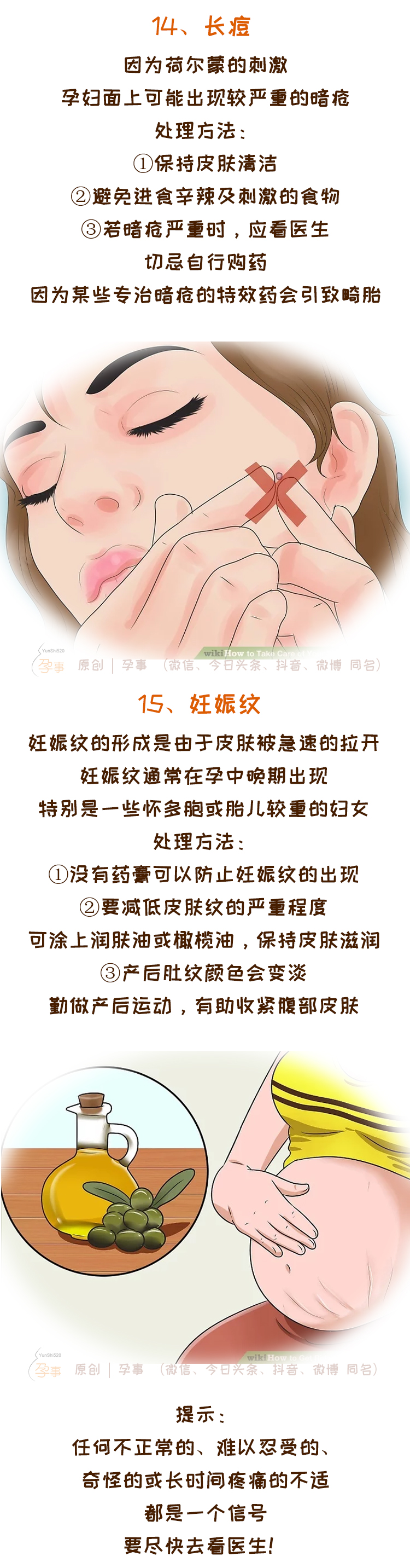 孕期应该知道的4件事,孕期应该知道的四件事