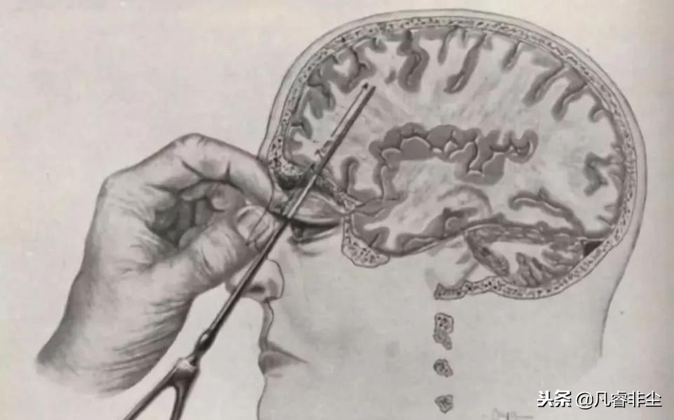 以未来的名义，请终身标记这些恶童