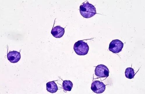 白带异常外阴瘙痒和什么有关系,外阴干涩白带多瘙痒疼痛