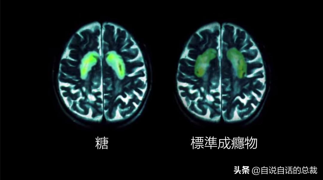 七种方法让你戒掉糖瘾,糖无处不在如何戒糖