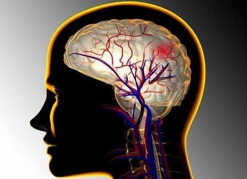 脑溢血的前兆和注意事项,脑溢血前兆和急救措施