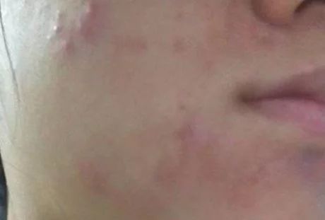 国货修护祛痘印护肤品推荐,堪比大牌平价护肤品