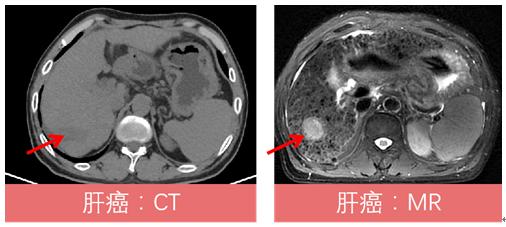 哈医大一院磁共振有片吗,哈医大一院能做内耳磁共振吗