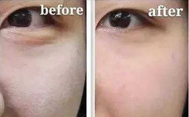 年纪不大为什么会有明显的法令纹,年纪轻轻为什么有很严重的法令纹