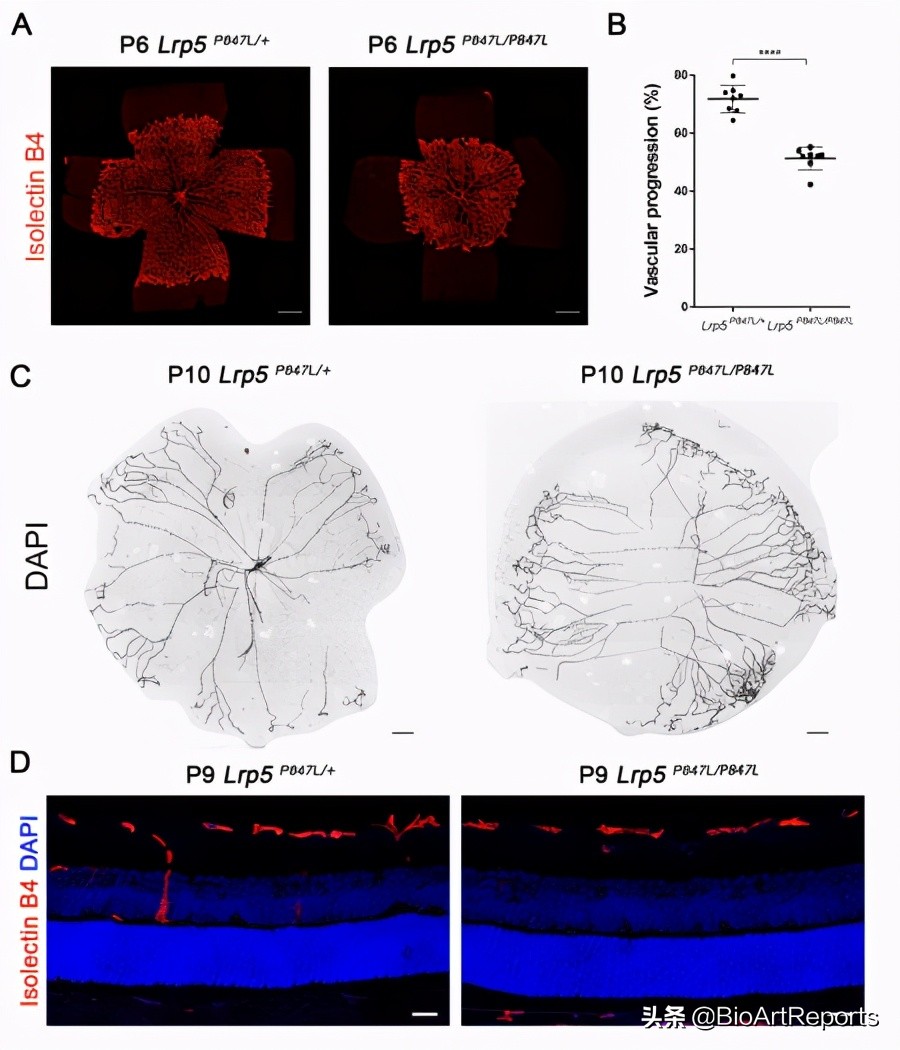 家族性视网膜病变是怎么回事,基因治疗视网膜病变最新进展