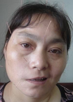 灏忎腑椋庝腑鍖昏兘鏍规不濂藉悧,涓尰娌绘剤浜嗗皬涓