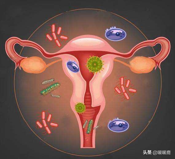 高度近视的孕妇可以顺产吗,高度近视孕妇剖腹产