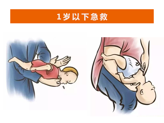 新生儿咳嗽湿疹,新生儿湿疹的治疗方法有问必答