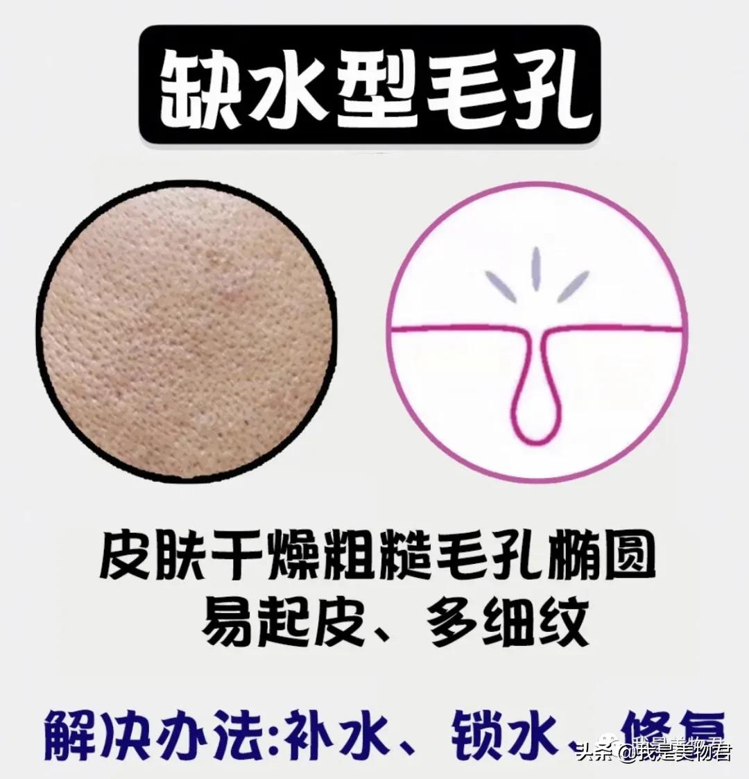 胸口毛孔粗大是什么原因,皮肤粗糙暗沉毛孔粗大什么原因