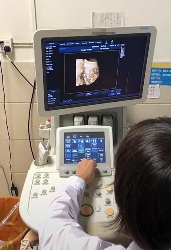 B超检查是男宝,宝爸盼女儿希望翻盘,为啥医生说有点困难?懂了