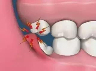 牙痛小知识科普,牙痛小常识分享给大家