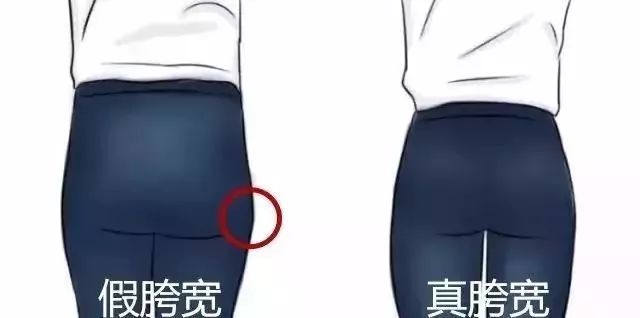 大腿粗屁股肥怎么办,最快最有效改善假胯宽和大腿