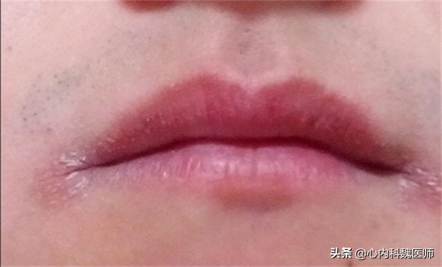 几毛钱的维生素b2治好病,几块钱一瓶的维生素b2能降血压吗