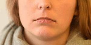 facs的全称是什么,facs面部编码系统