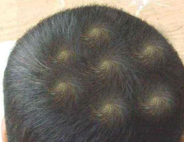 孩子头顶有两个旋性格,男孩头顶两个旋迷信说法