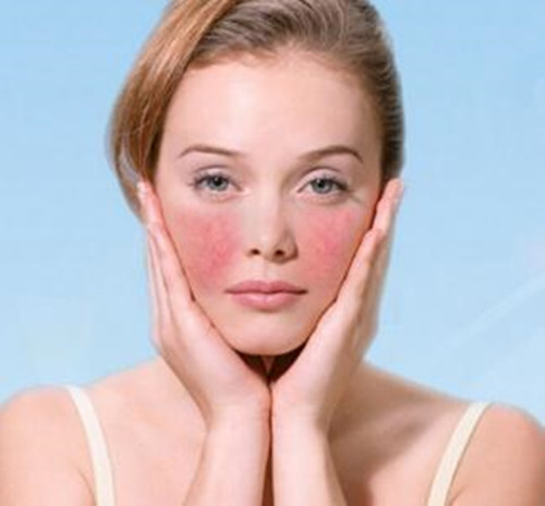 皮肤过敏干燥起皮紧绷护肤,敏感皮肤干的起皮用什么