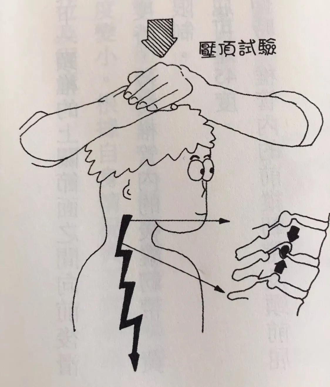 颈椎病手臂麻木疼痛针灸,颈椎病引起手臂麻木特效穴