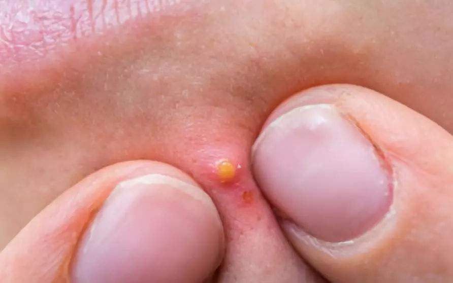 毛孔粗大惹人烦，睡前4个好习惯，2个月变0毛孔牛奶肌