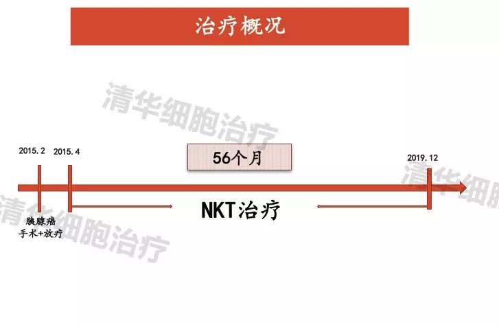 胰腺癌免疫治疗最新消息,最新胰腺癌免疫疗法