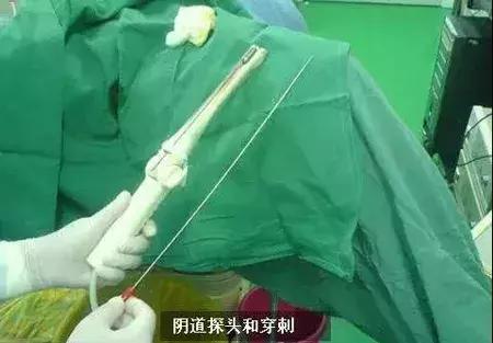 以爱之名诈骗女子,以爱之名征婚骗局