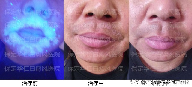 “他们待我如亲人”！患者辗转300余公里，连送保定华仁医院三面锦旗！