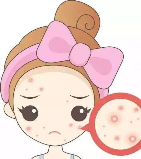 油性皮肤怎么改善不花钱,油性皮肤的正确护肤方法