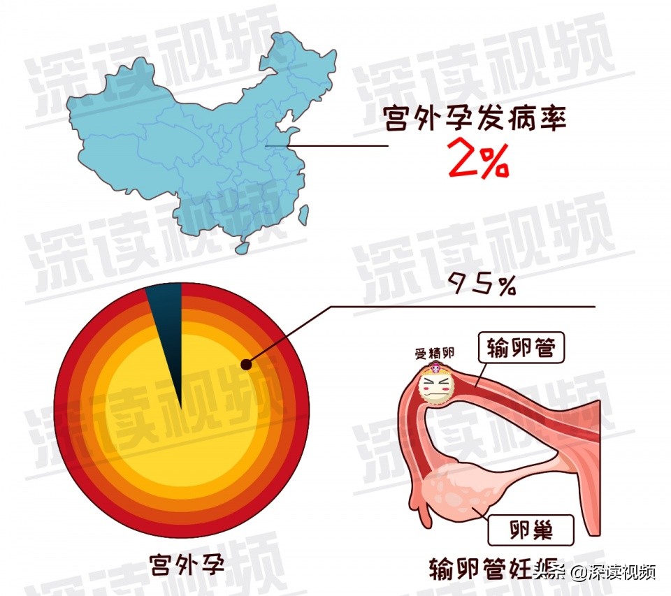 关爱女性|3.8妇女节深读特别节目——《宫外孕专题》