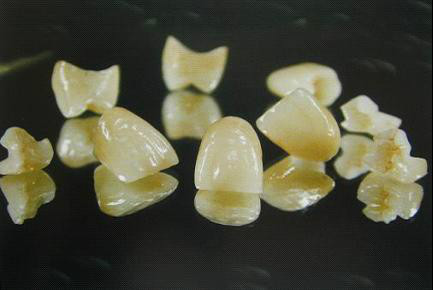 现在最便宜的假牙多少钱一颗,目前国内最好的假牙是多少钱