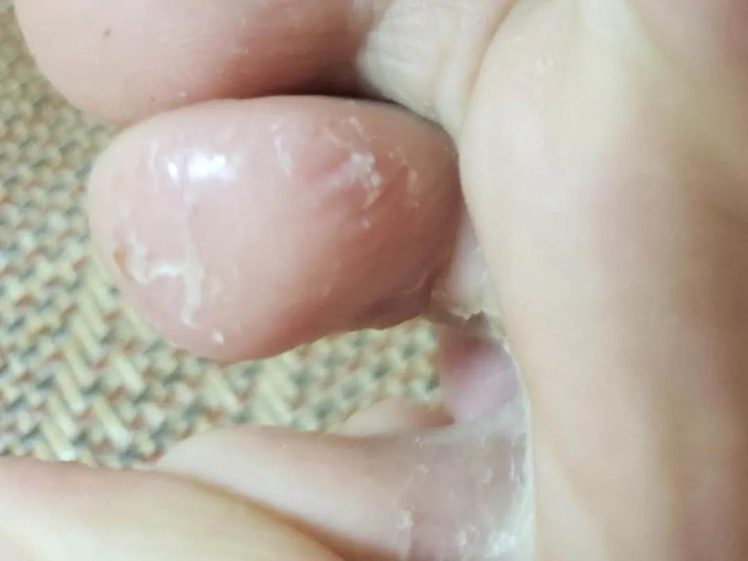 沈腾推荐治疗腿疼,沈腾的神奇功效