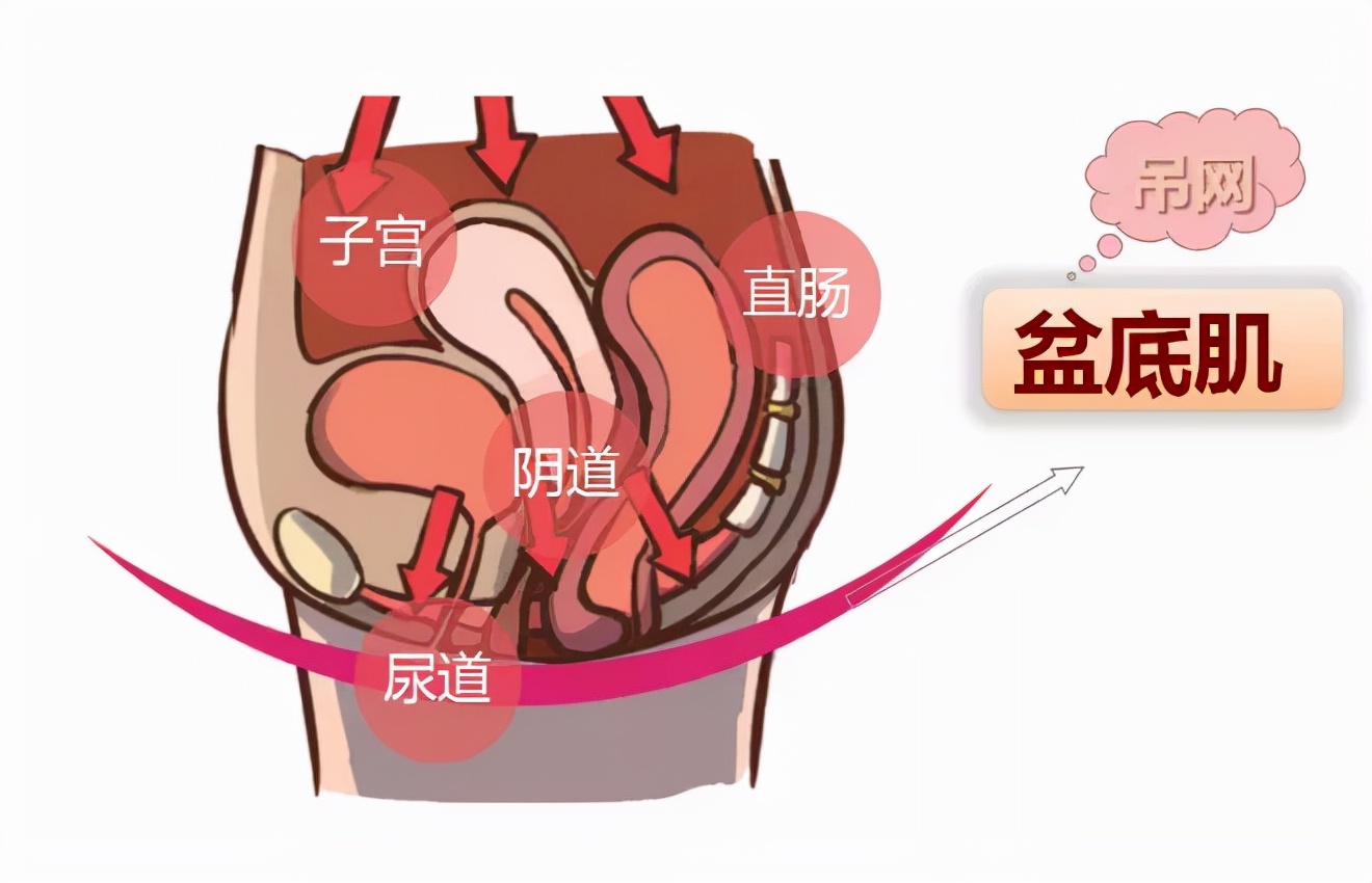 产后一年错过修复黄金时期，做盆底肌修复还有用吗？