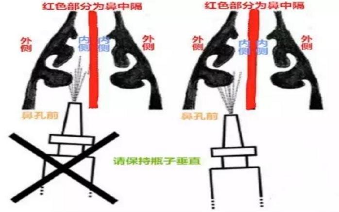 使用鼻喷雾老感觉咽下去了,用鼻喷剂后失去嗅觉