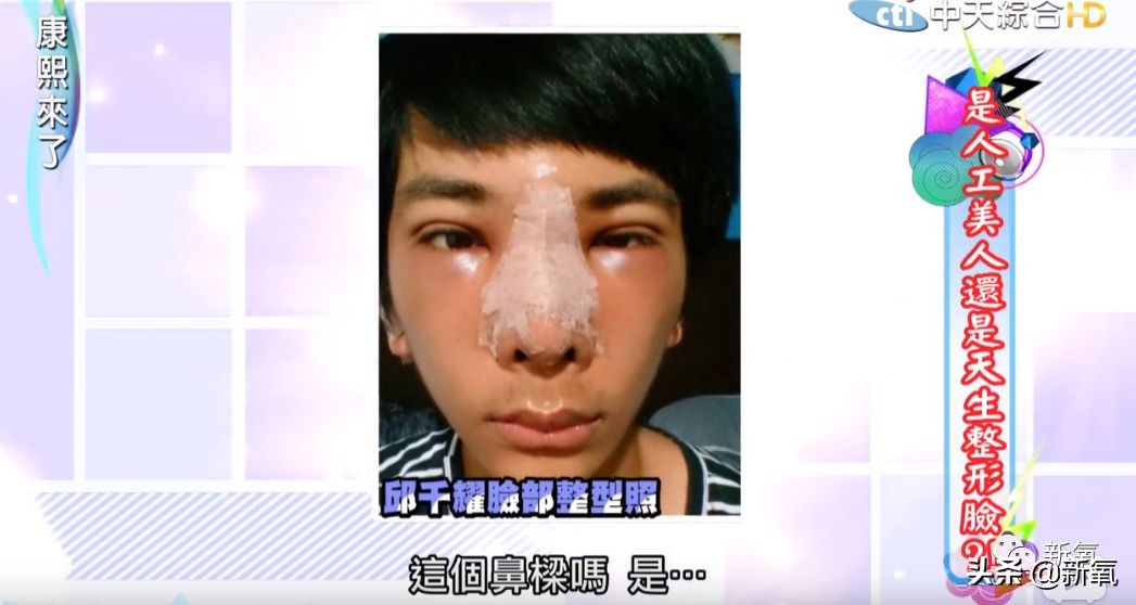 花90万从头整到脚，还可以这么自然？旁边纯天然小姐姐都看懵了